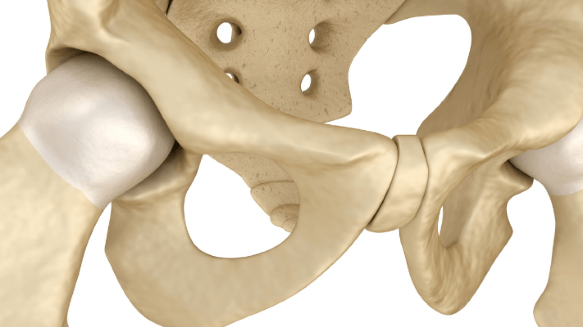 Osteitis Pubis in Runners, Pubic-related Groin Pain